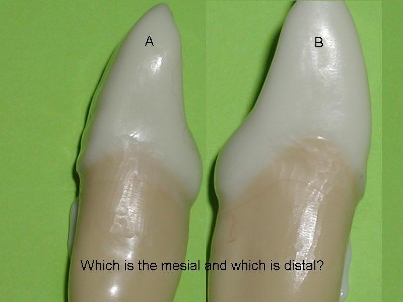 A=distal & B=mesial